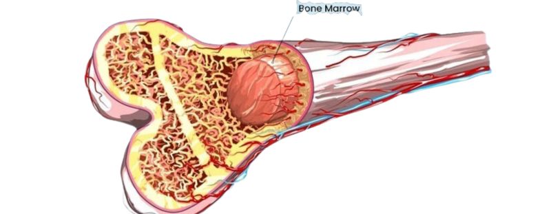 Bone Marrow Transplant
