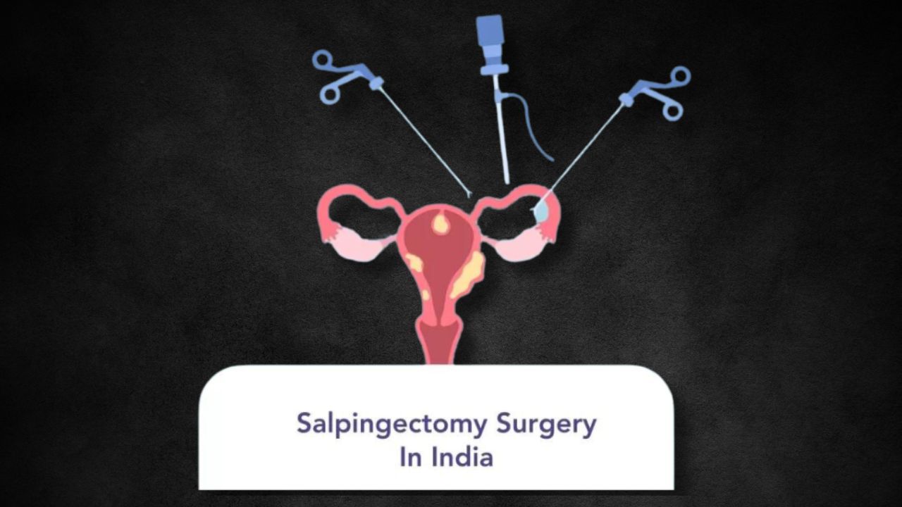 Salpingectomy Surgery