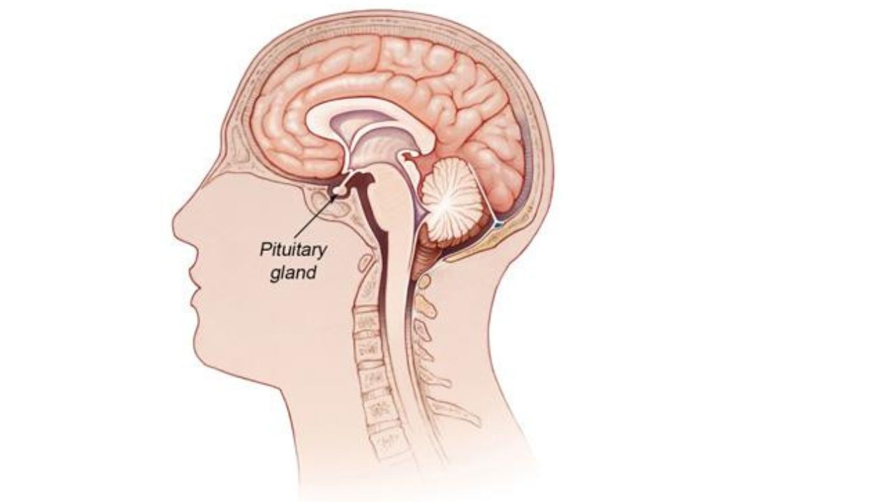Pituitary Tumor In India