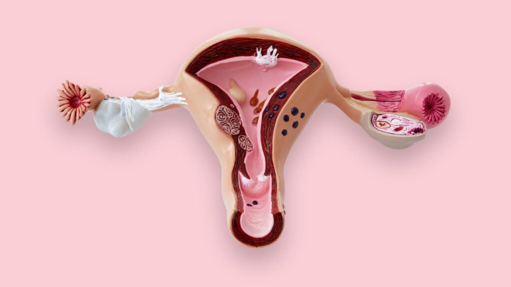 Uterus Transplant In India