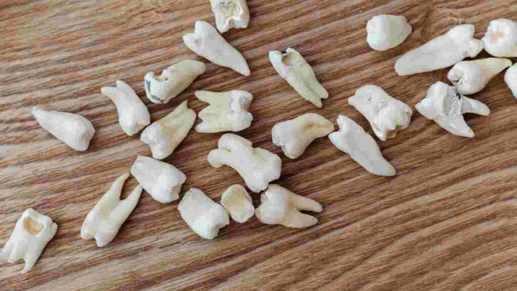 Low-Cost Dental Implants In India