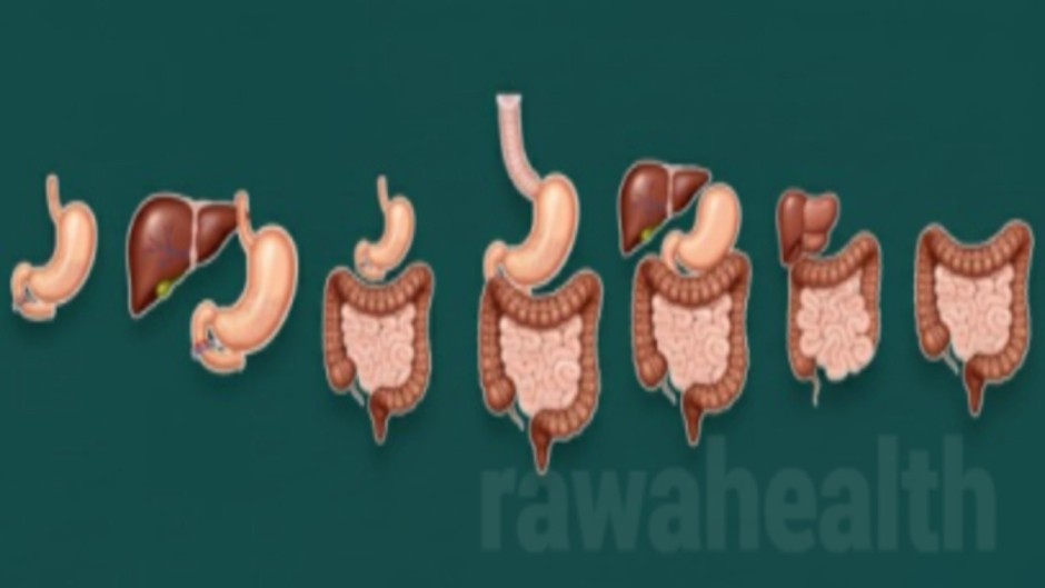 Stomach Surgery in India