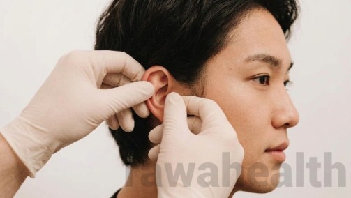 Ears Pinned Back Surgery in India